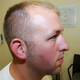 Illustration for article titled Here Are Images the Grand Jury Saw of Darren Wilson's Injuries